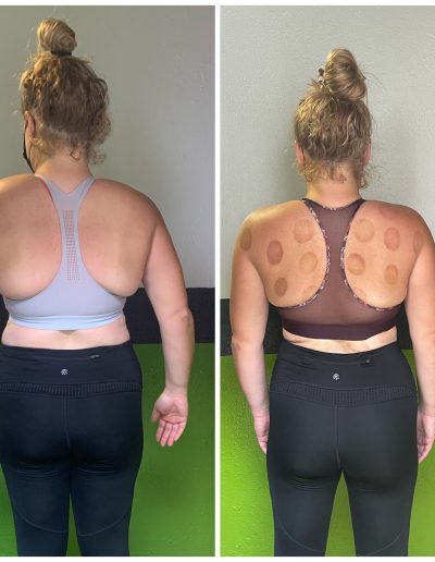 Before and after pic from back 5